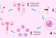 Will ivf really be the next frontier in americas culture wars