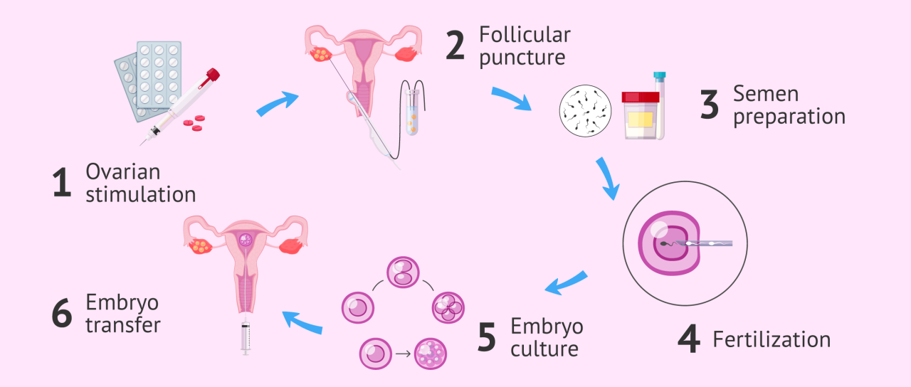 Will ivf really be the next frontier in americas culture wars