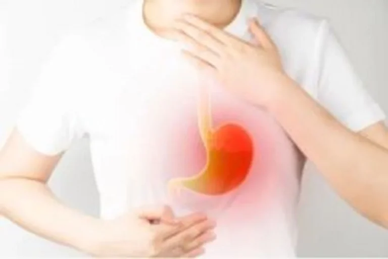 Understanding GERD: Chronic Digestive Disorder on the Rise, Affecting Younger Generations