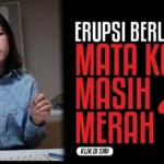 Erupsi Berlalu, Kok Mata Masih Merah? Ini Kemungkinannya Menurut Dokter Mata