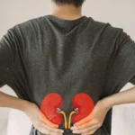 Navigating Chronic Kidney Disease: Debunking Five Common Misconceptions About Renal Health