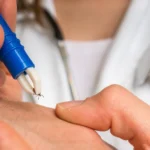 Ngeri, Ilmuwan China Temukan Virus Baru yang Ditularkan Kutu
