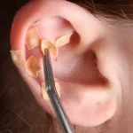 Viral Tren Atasi Stres dengan Ear Seeds, Banyak Digemari Idol K-Pop