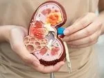 Silent Killers in Youth: The Rising Crisis of Pediatric Kidney Failure in Indonesia