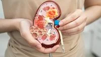 Silent Killers in Youth: The Rising Crisis of Pediatric Kidney Failure in Indonesia