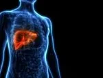 Suka Minuman Manis dan Sering Lelah? Waspada Fatty Liver